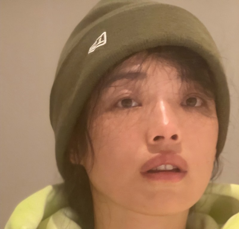 45岁舒淇自曝长期失眠（舒淇满脸憔悴干纹太明显）
