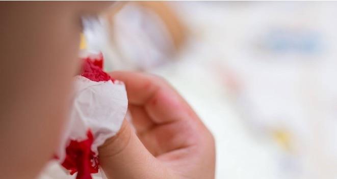 生活小孩子经常流鼻血会是白血病吗 孩子流鼻血了家长怎么办 1